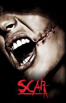 Scar
